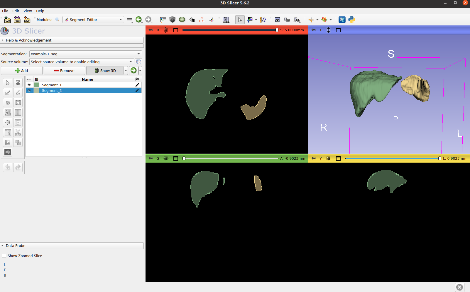 3D Slicer 渲染示例 3