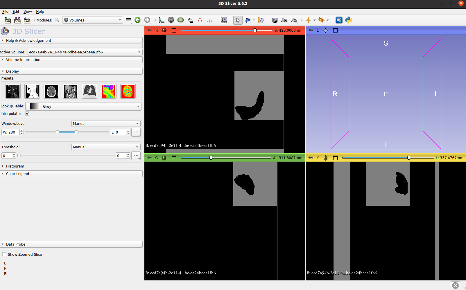 3D Slicer Rendering Example 4